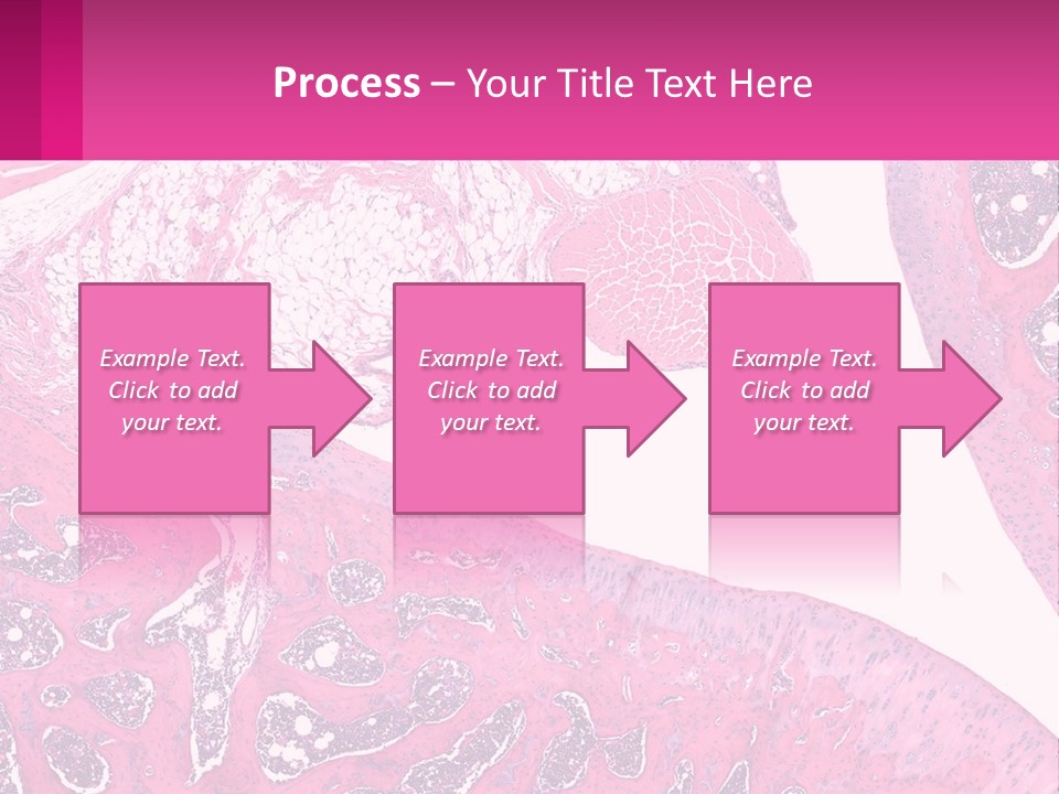 An Image Of A Section Of The Stomach With The Name Of The Organ PowerPoint Template