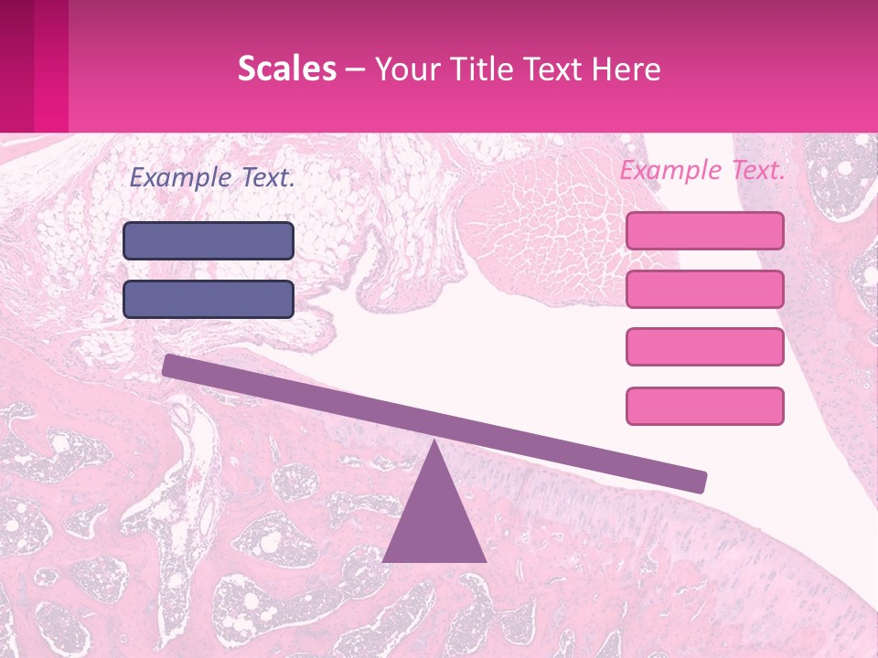 An Image Of A Section Of The Stomach With The Name Of The Organ PowerPoint Template