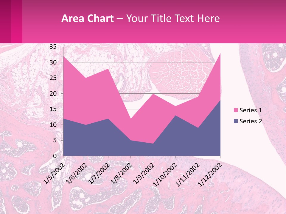 An Image Of A Section Of The Stomach With The Name Of The Organ PowerPoint Template