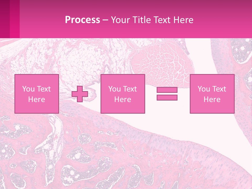 An Image Of A Section Of The Stomach With The Name Of The Organ PowerPoint Template