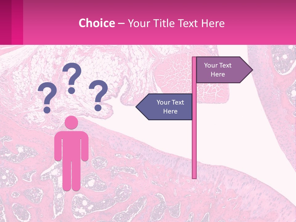 An Image Of A Section Of The Stomach With The Name Of The Organ PowerPoint Template