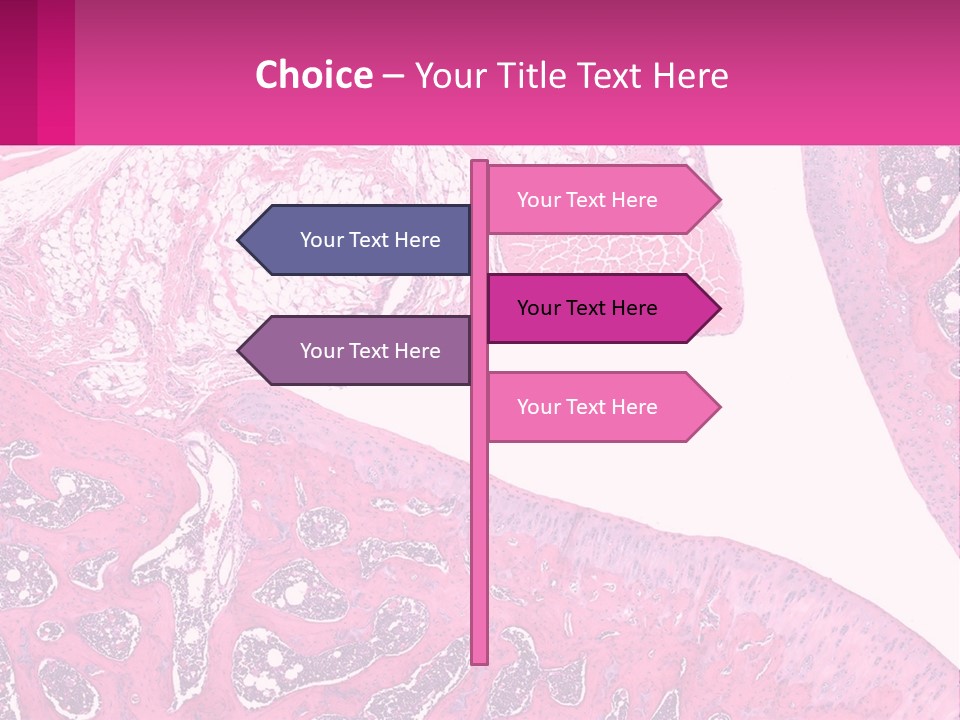 An Image Of A Section Of The Stomach With The Name Of The Organ PowerPoint Template