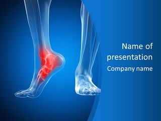 A Medical Powerpoint Presentation With A Highlighted Foot PowerPoint Template
