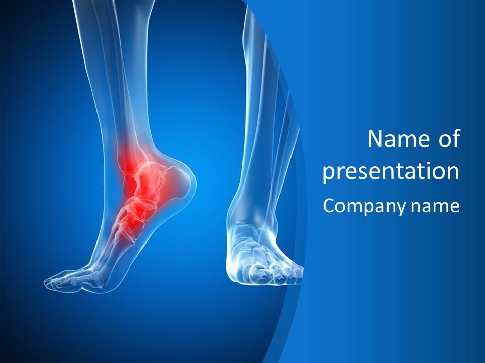 A Medical Powerpoint Presentation With A Highlighted Foot PowerPoint Template