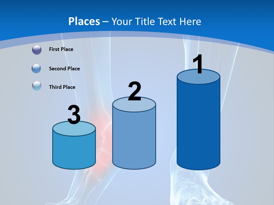 A Medical Powerpoint Presentation With A Highlighted Foot PowerPoint Template