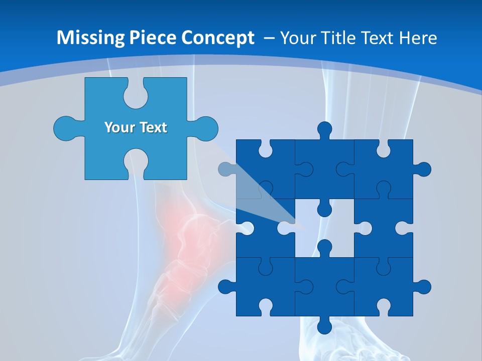 A Medical Powerpoint Presentation With A Highlighted Foot PowerPoint Template