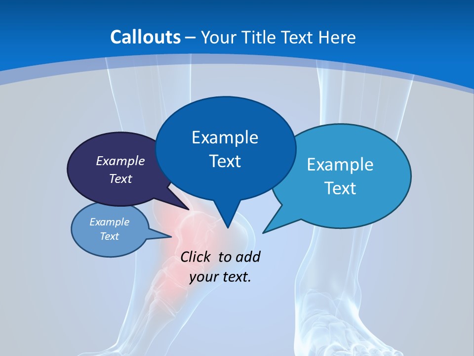 A Medical Powerpoint Presentation With A Highlighted Foot PowerPoint Template