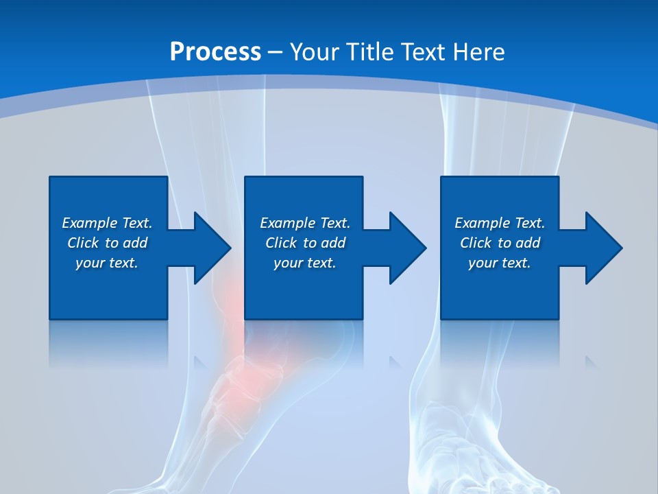 A Medical Powerpoint Presentation With A Highlighted Foot PowerPoint Template