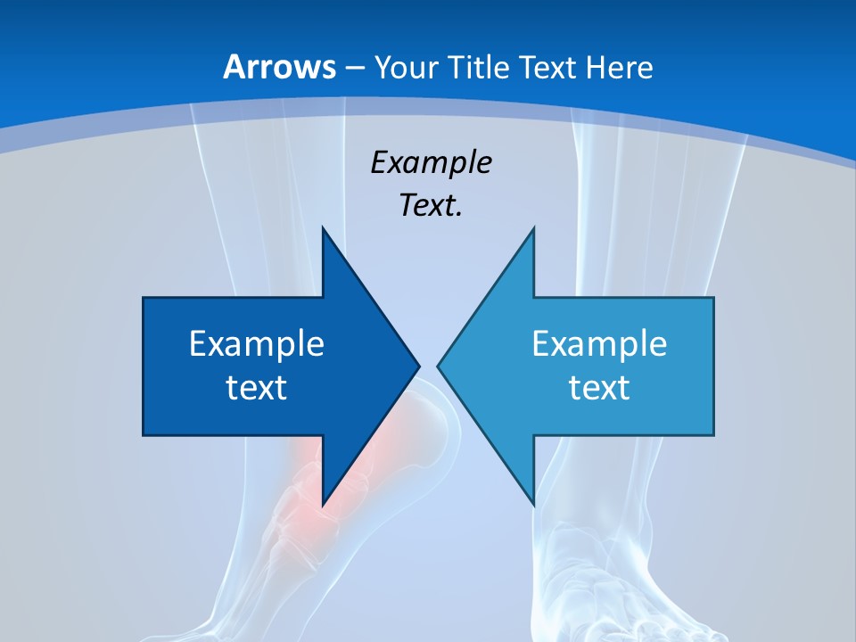 A Medical Powerpoint Presentation With A Highlighted Foot PowerPoint Template