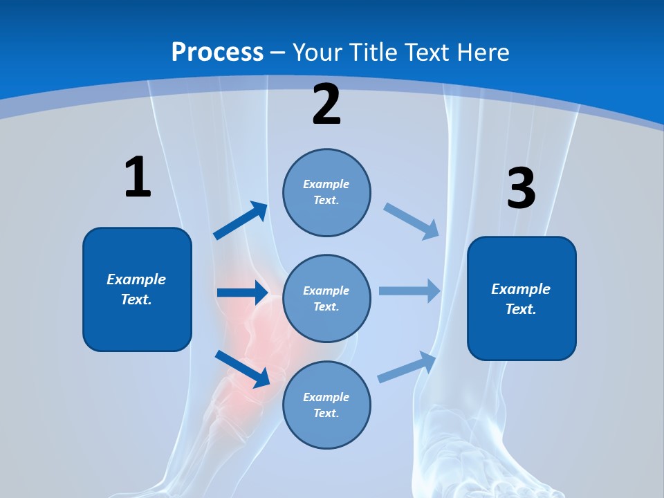 A Medical Powerpoint Presentation With A Highlighted Foot PowerPoint Template