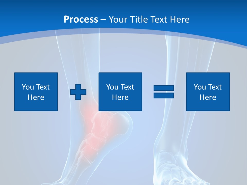 A Medical Powerpoint Presentation With A Highlighted Foot PowerPoint Template