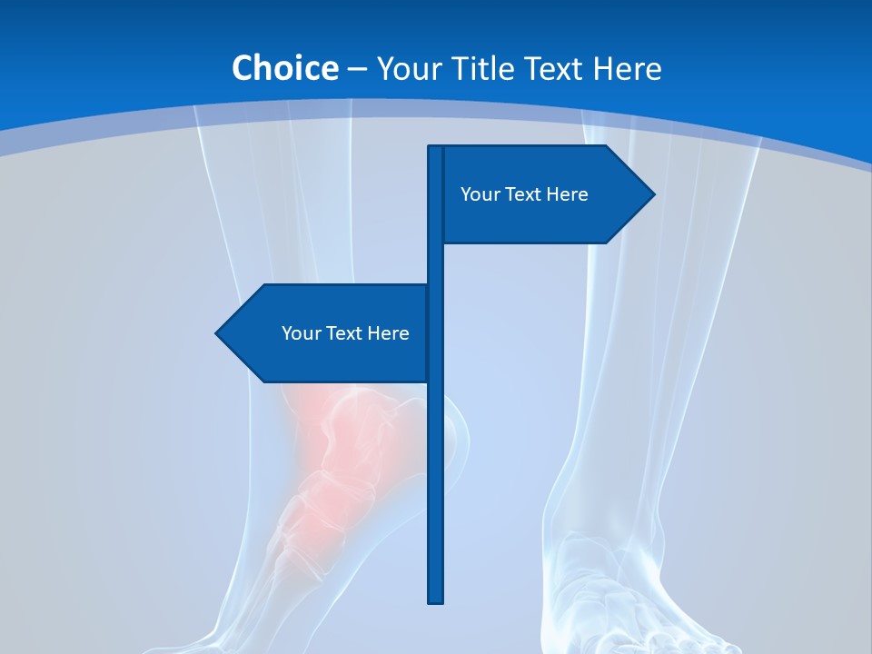 A Medical Powerpoint Presentation With A Highlighted Foot PowerPoint Template