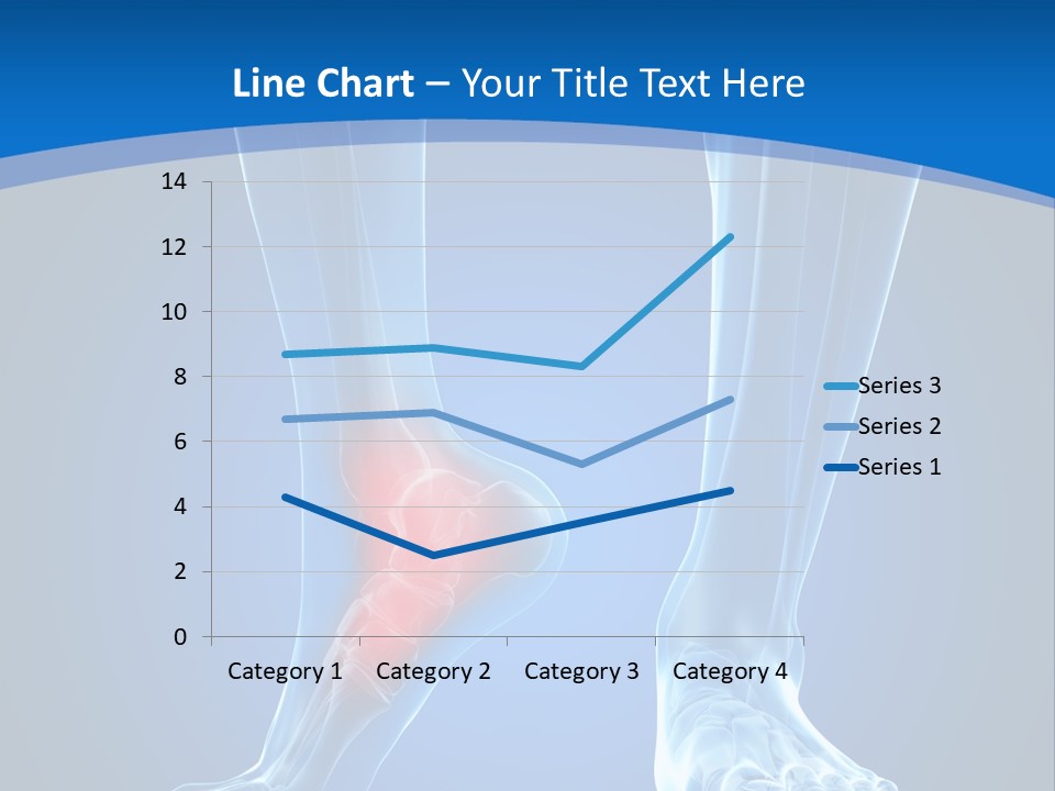 A Medical Powerpoint Presentation With A Highlighted Foot PowerPoint Template