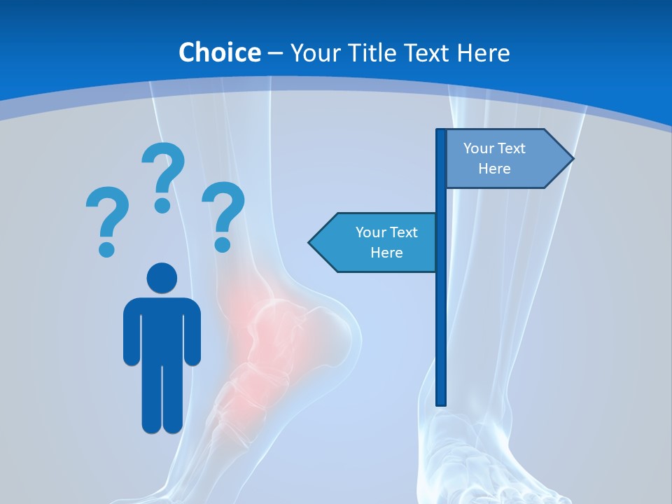 A Medical Powerpoint Presentation With A Highlighted Foot PowerPoint Template