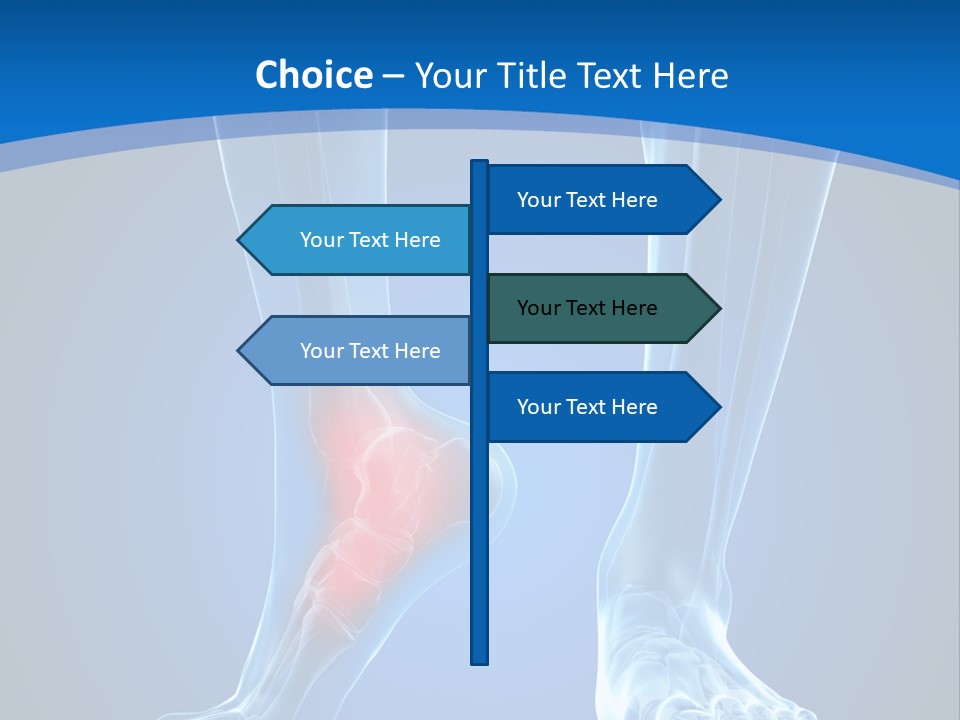 A Medical Powerpoint Presentation With A Highlighted Foot PowerPoint Template