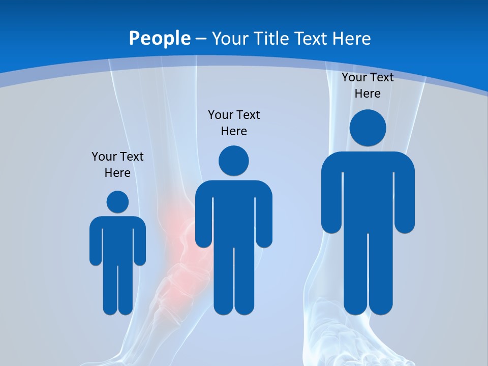 A Medical Powerpoint Presentation With A Highlighted Foot PowerPoint Template