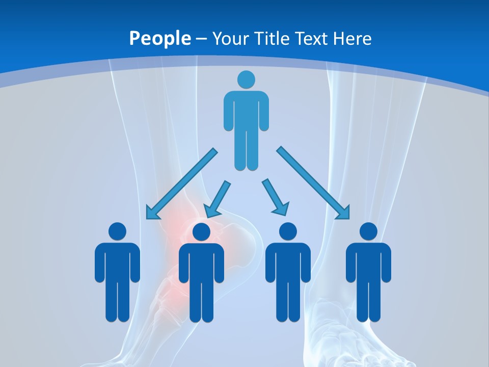 A Medical Powerpoint Presentation With A Highlighted Foot PowerPoint Template