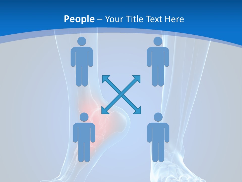 A Medical Powerpoint Presentation With A Highlighted Foot PowerPoint Template