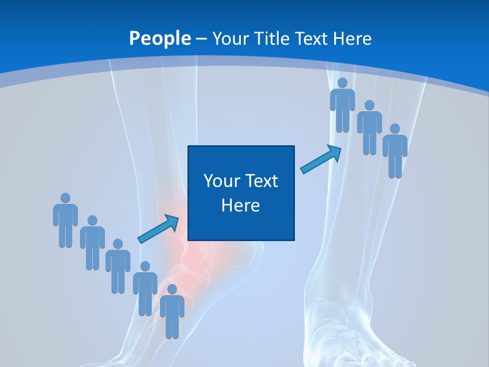 A Medical Powerpoint Presentation With A Highlighted Foot PowerPoint Template