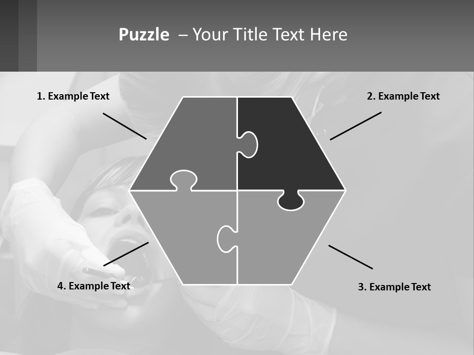 A Young Boy Getting His Teeth Checked By A Dentist PowerPoint Template