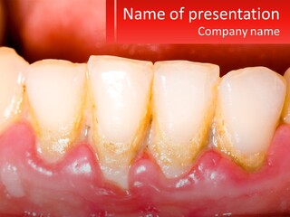 A Close Up Of A Tooth With A Red Background PowerPoint Template