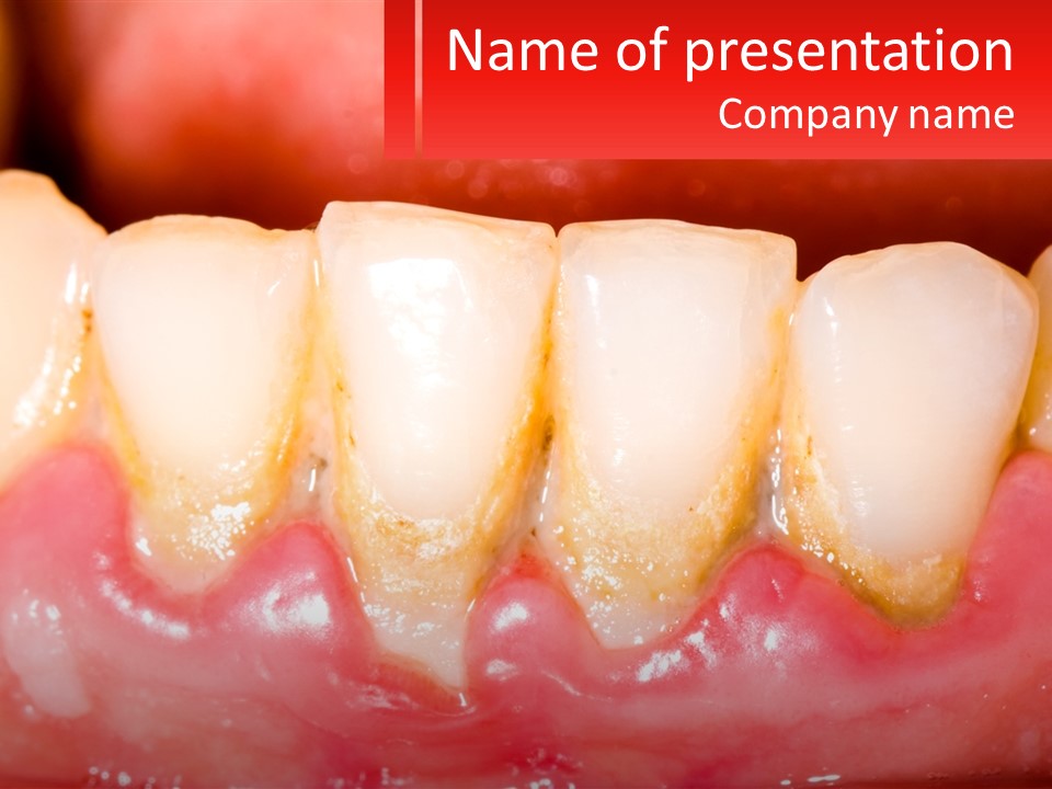 A Close Up Of A Tooth With A Red Background PowerPoint Template
