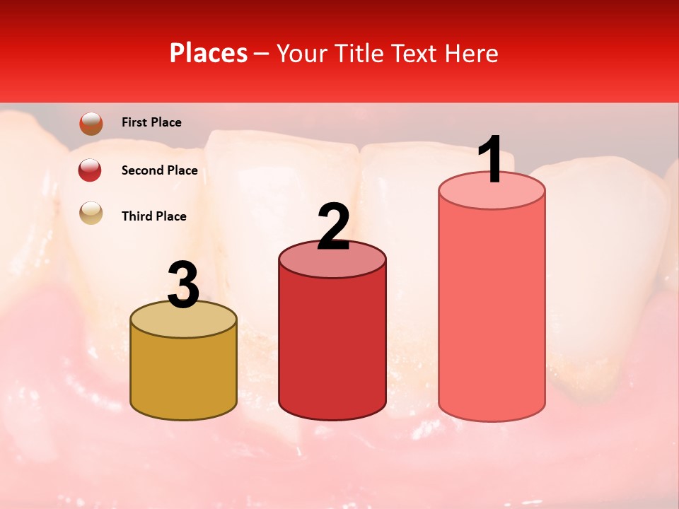 A Close Up Of A Tooth With A Red Background PowerPoint Template