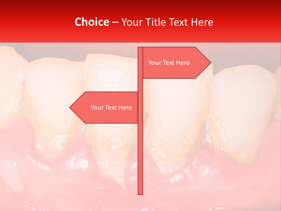 A Close Up Of A Tooth With A Red Background PowerPoint Template