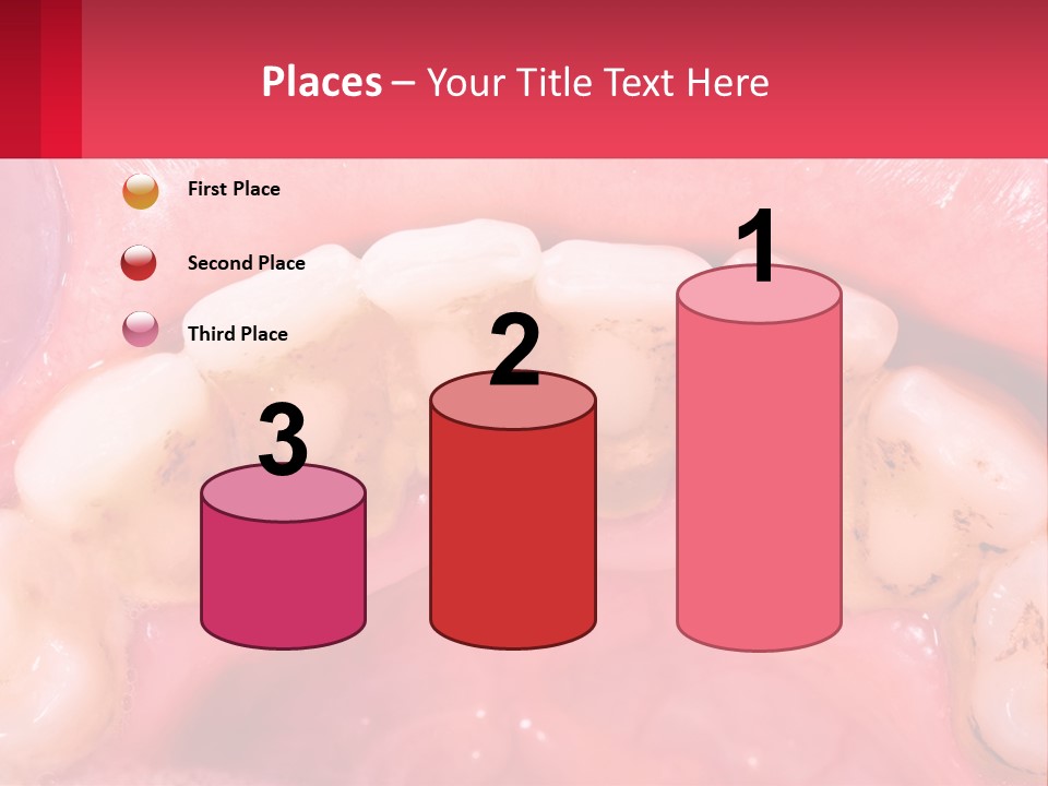 A Close Up Of A Tooth With Molds On It PowerPoint Template