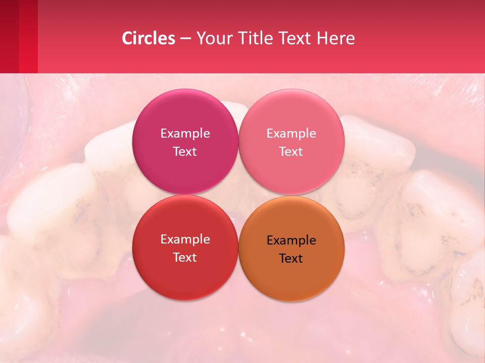 A Close Up Of A Tooth With Molds On It PowerPoint Template