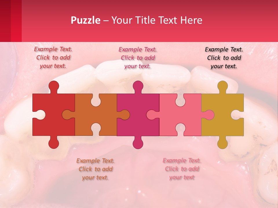 A Close Up Of A Tooth With Molds On It PowerPoint Template