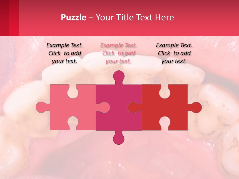 A Close Up Of A Tooth With Molds On It PowerPoint Template