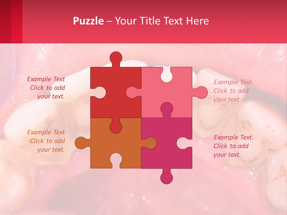 A Close Up Of A Tooth With Molds On It PowerPoint Template