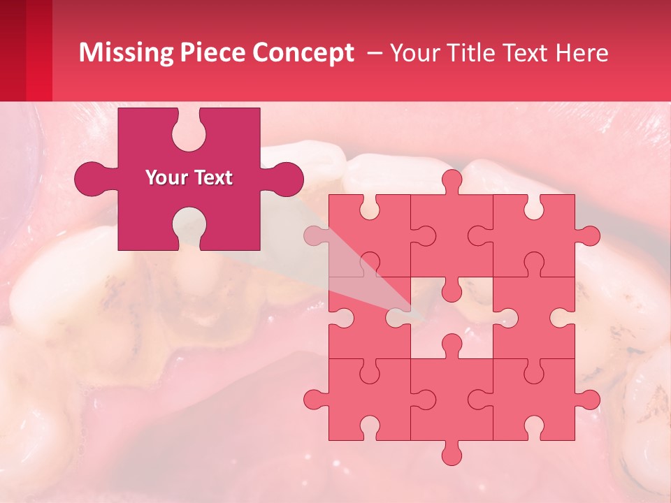 A Close Up Of A Tooth With Molds On It PowerPoint Template