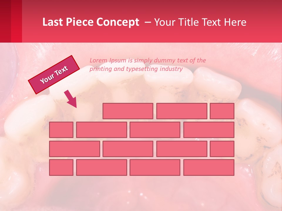 A Close Up Of A Tooth With Molds On It PowerPoint Template