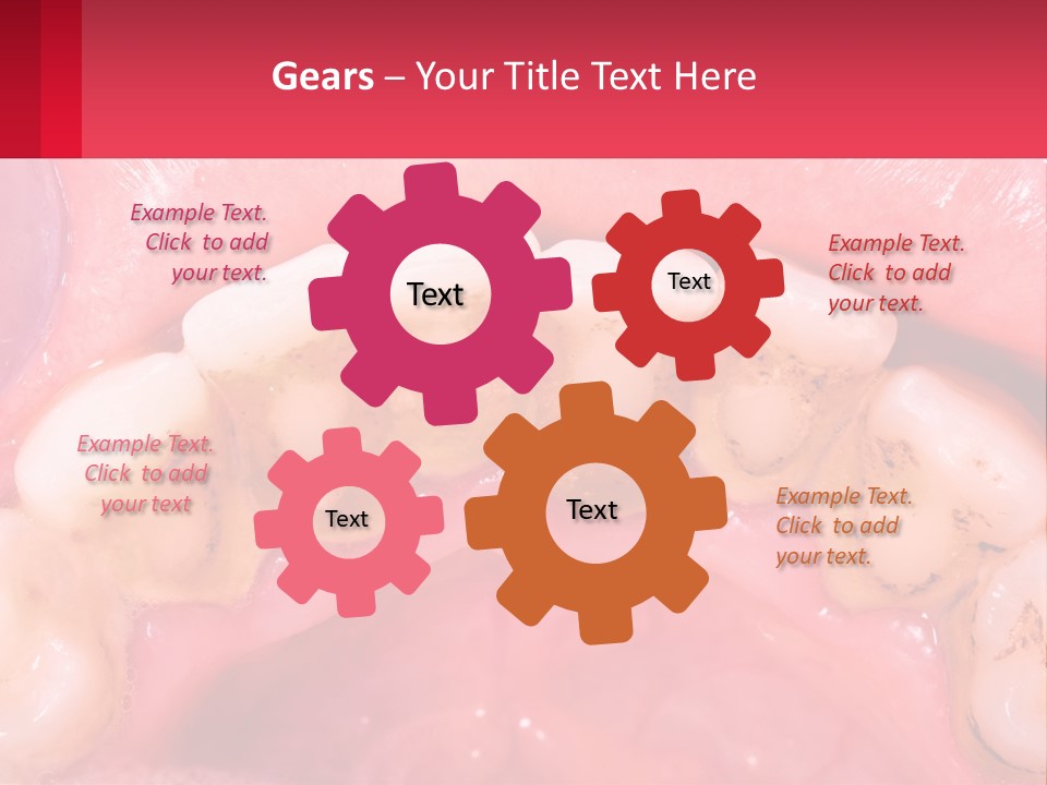 A Close Up Of A Tooth With Molds On It PowerPoint Template