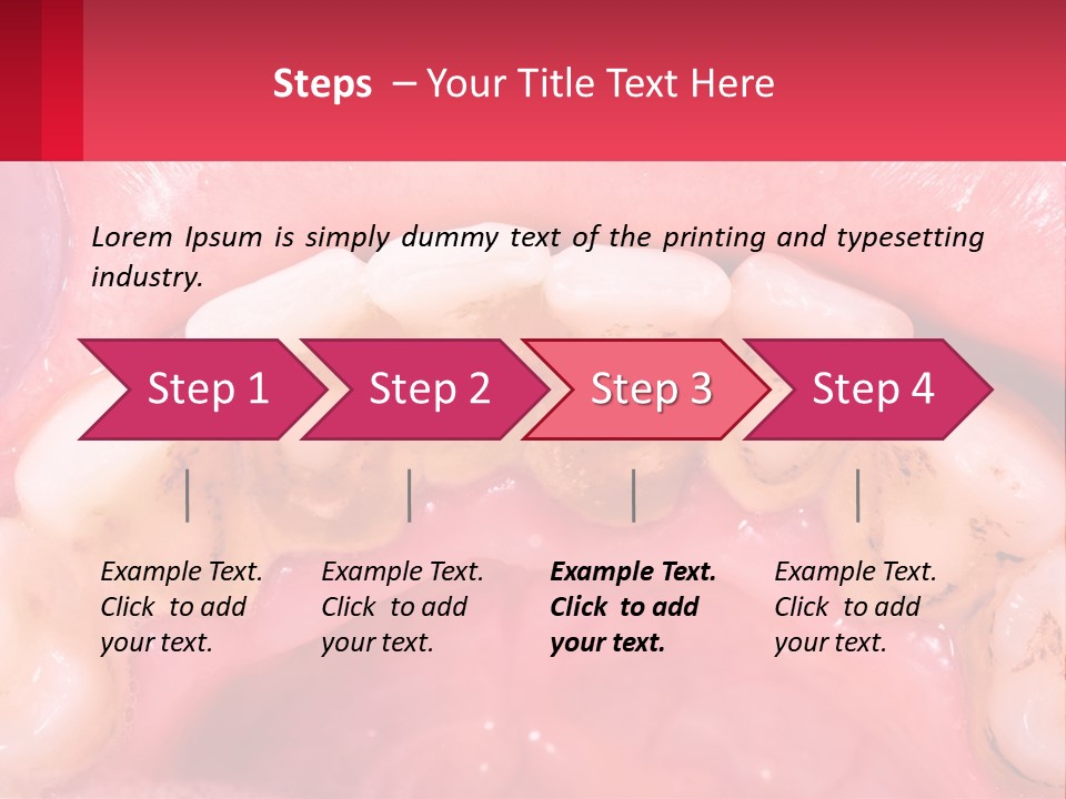 A Close Up Of A Tooth With Molds On It PowerPoint Template