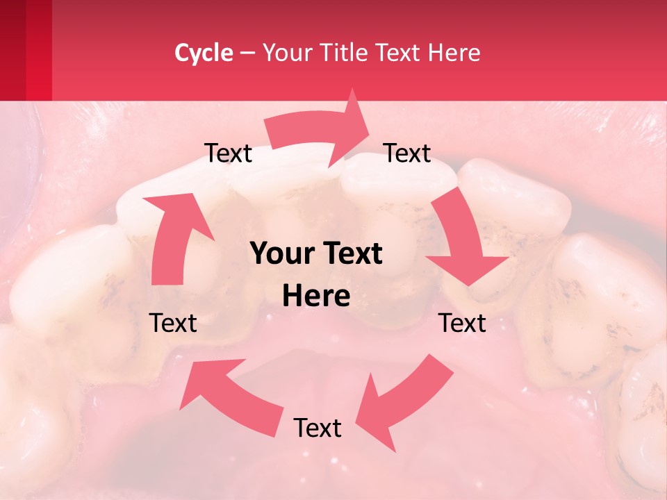 A Close Up Of A Tooth With Molds On It PowerPoint Template