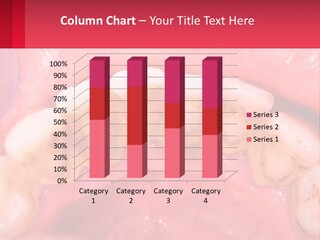 A Close Up Of A Tooth With Molds On It PowerPoint Template