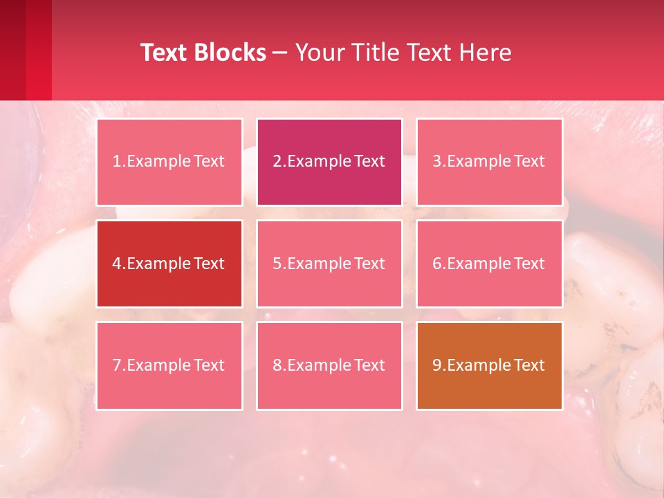 A Close Up Of A Tooth With Molds On It PowerPoint Template