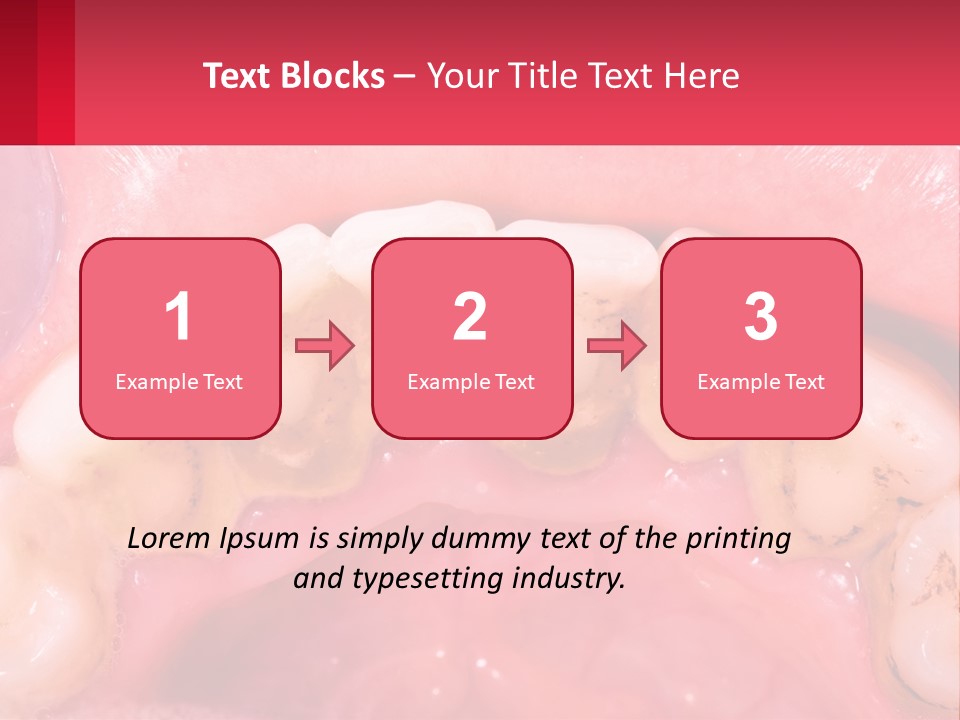A Close Up Of A Tooth With Molds On It PowerPoint Template