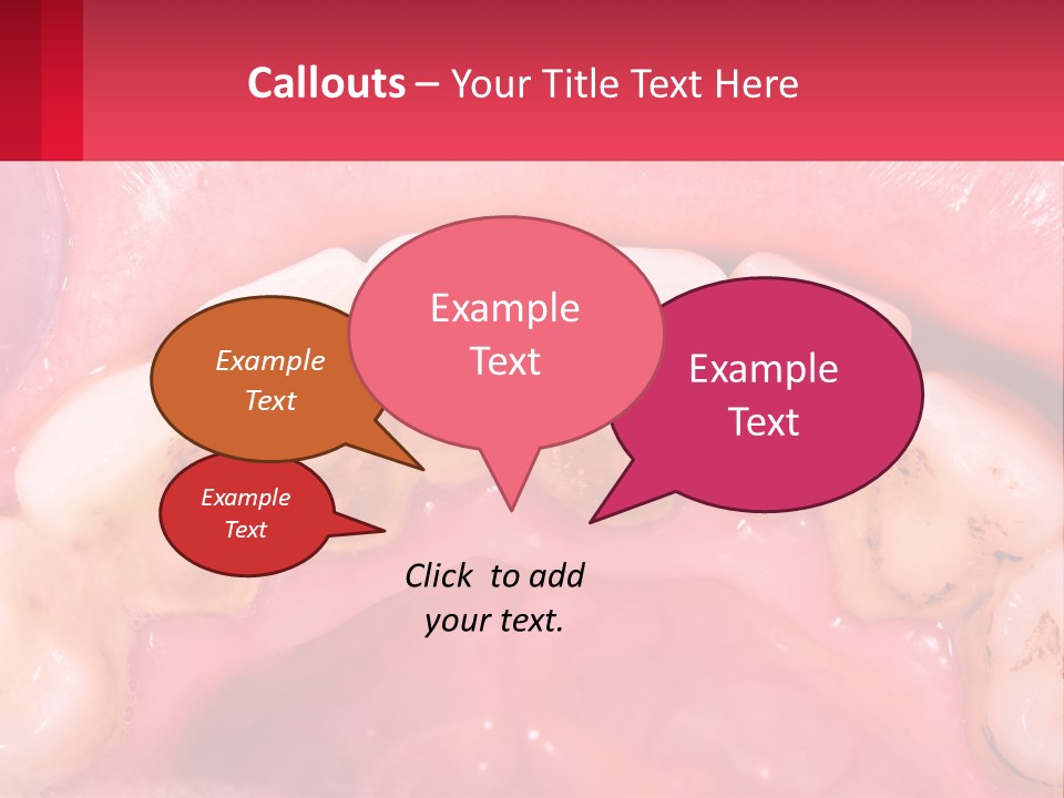A Close Up Of A Tooth With Molds On It PowerPoint Template