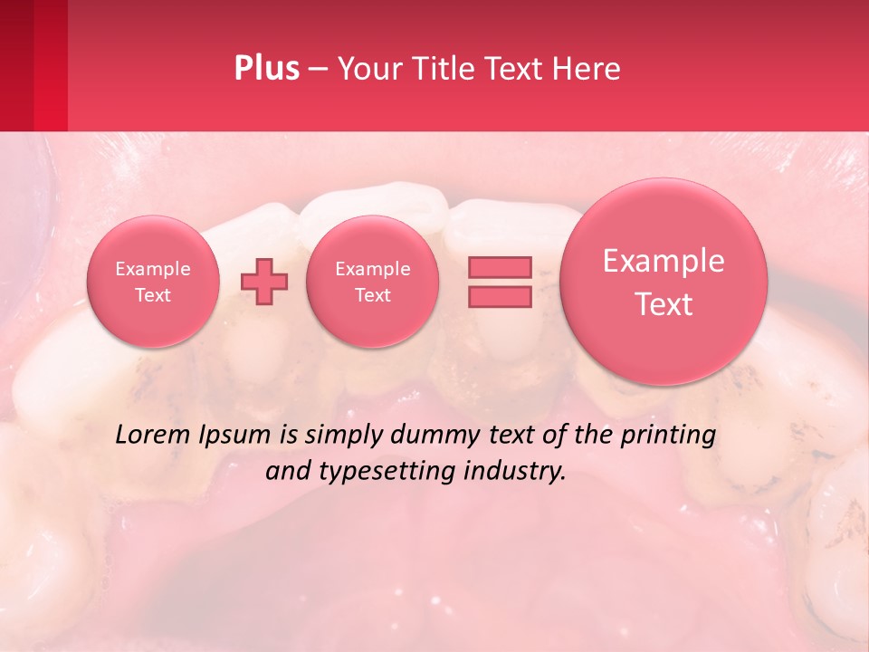 A Close Up Of A Tooth With Molds On It PowerPoint Template