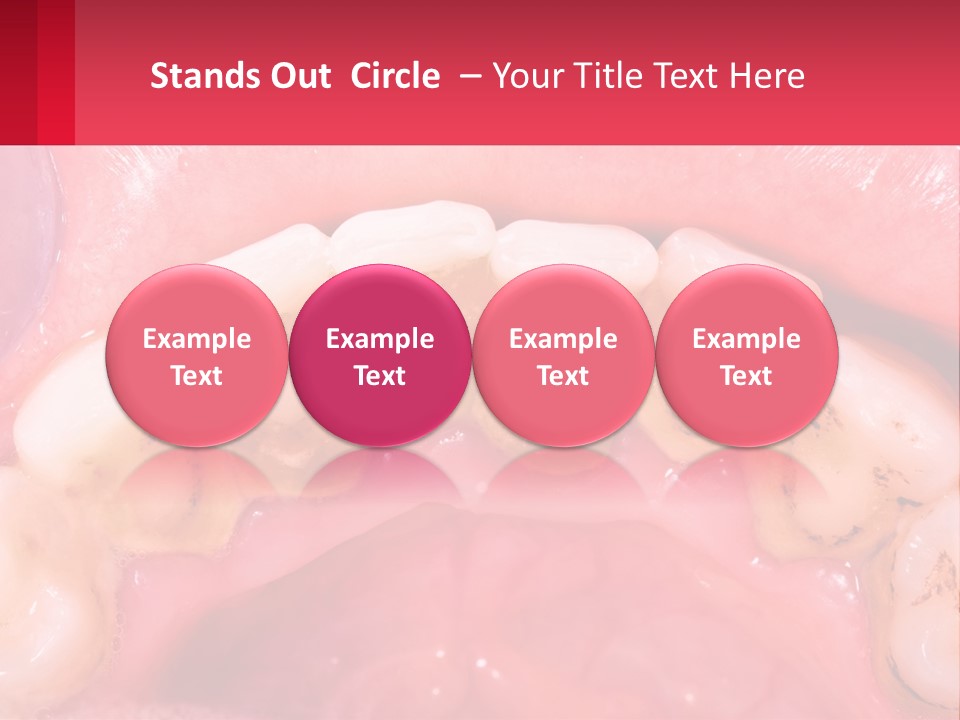 A Close Up Of A Tooth With Molds On It PowerPoint Template