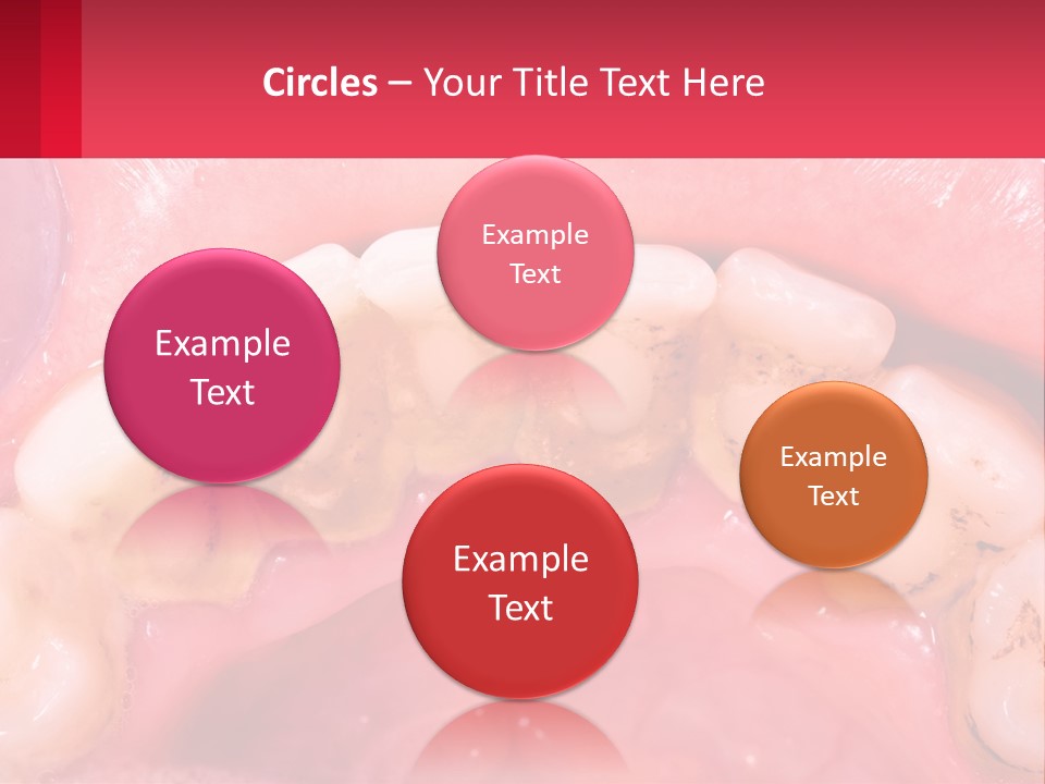 A Close Up Of A Tooth With Molds On It PowerPoint Template