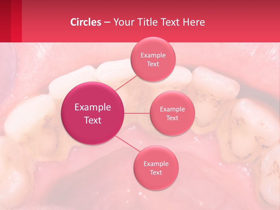 A Close Up Of A Tooth With Molds On It PowerPoint Template