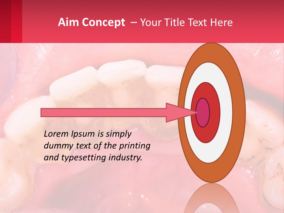 A Close Up Of A Tooth With Molds On It PowerPoint Template