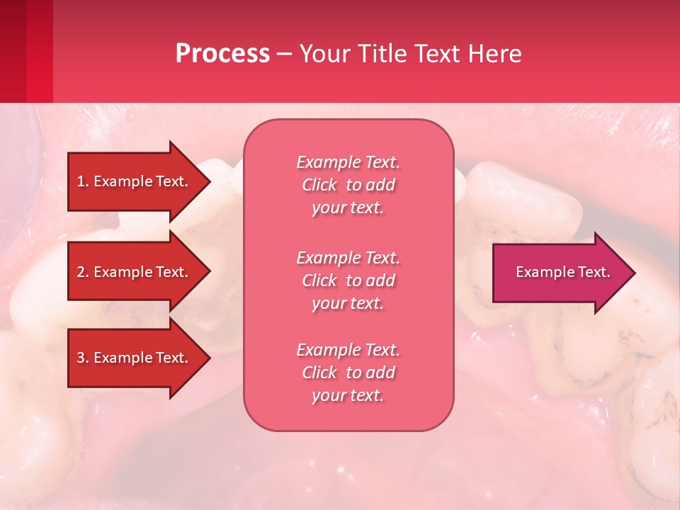 A Close Up Of A Tooth With Molds On It PowerPoint Template