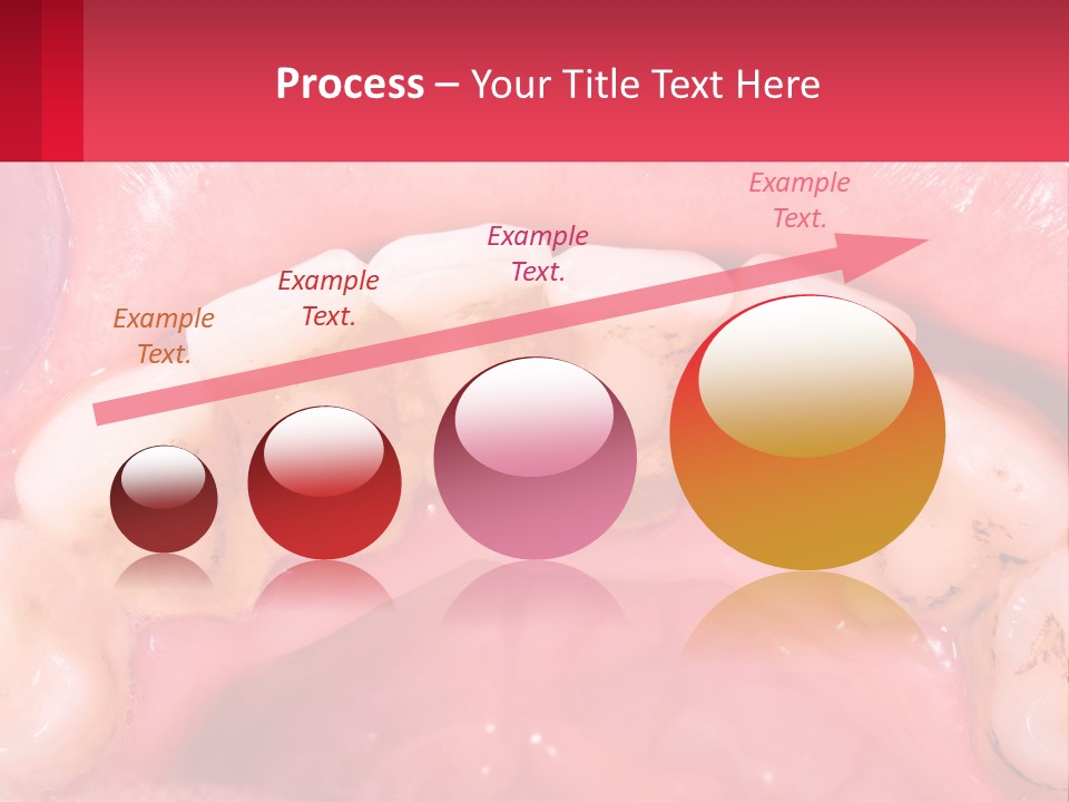 A Close Up Of A Tooth With Molds On It PowerPoint Template