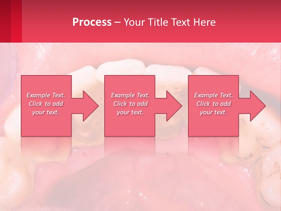 A Close Up Of A Tooth With Molds On It PowerPoint Template